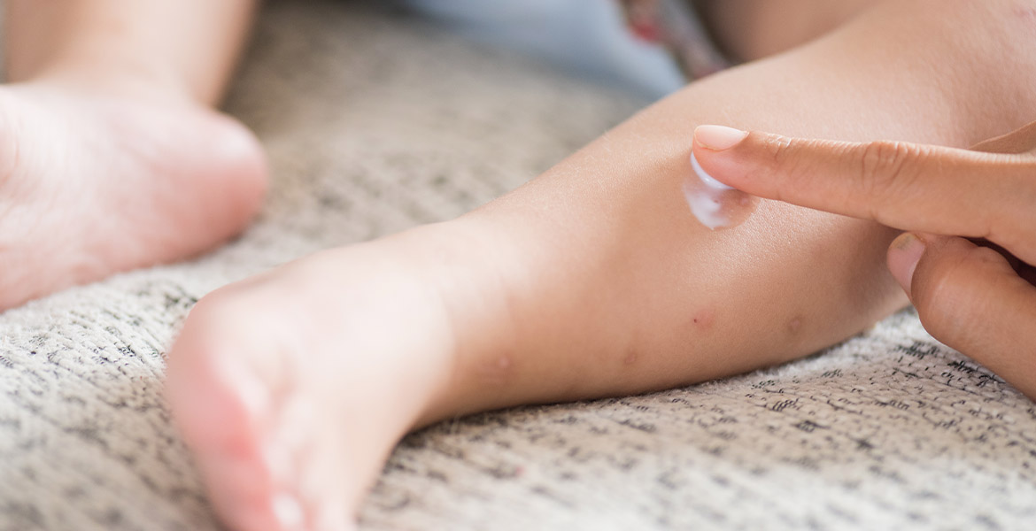 Anti-moustiques bébé, Santé naturelle